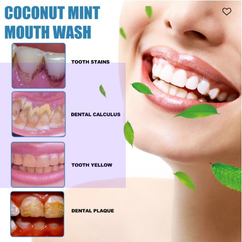 Oralhoe Coconut Mint Mouth Wash, Whitening Teeth Yellow Teeth Stains Tongue Coating Clean Breath Oral Care