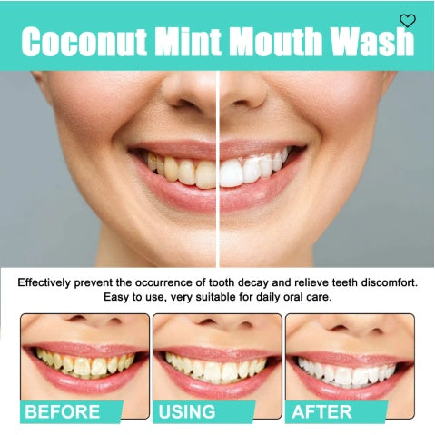 Oralhoe Coconut Mint Mouth Wash, Whitening Teeth Yellow Teeth Stains Tongue Coating Clean Breath Oral Care